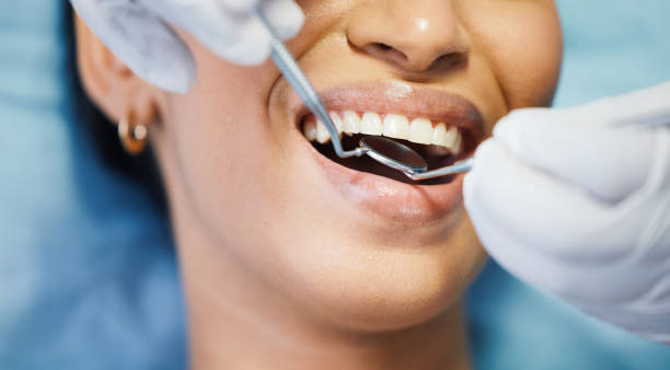 Best Emergency Dental Extractions in Wailea, HI