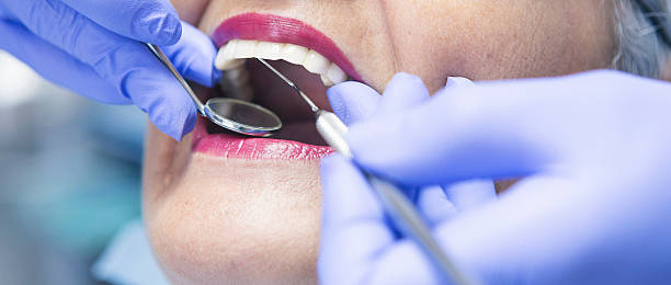 Best Emergency Dentist for Lost Fillings or Crowns in Wailea, HI
